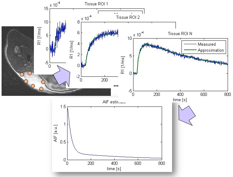 Perfusion MRI: Blind-deconvolution AIF estimation