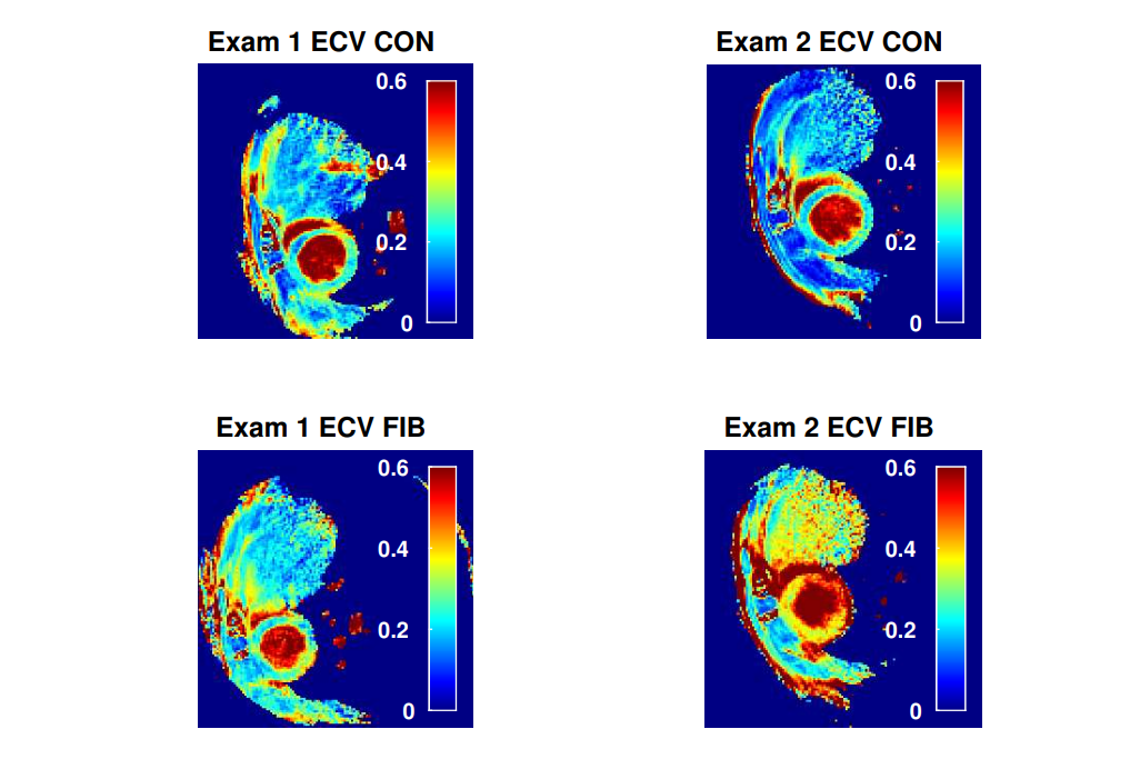 T1 relaxometry: self-gated quantification in the rat’s myocardium