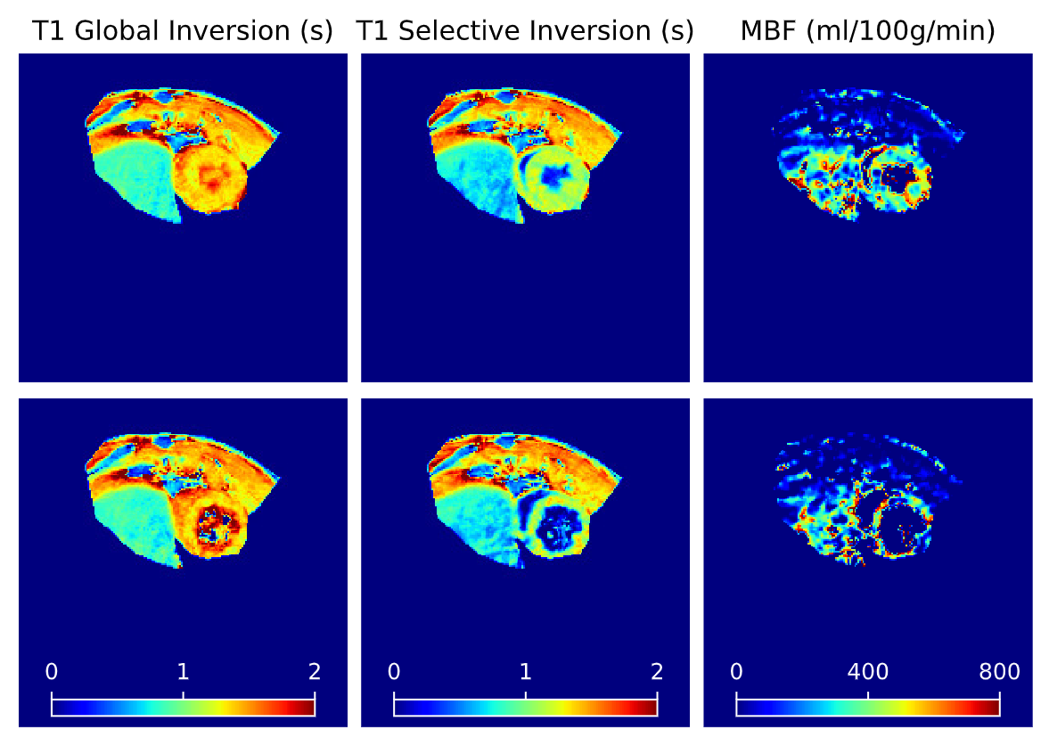 Perfusion MRI: Self-gated cardiac FAIR-ASL