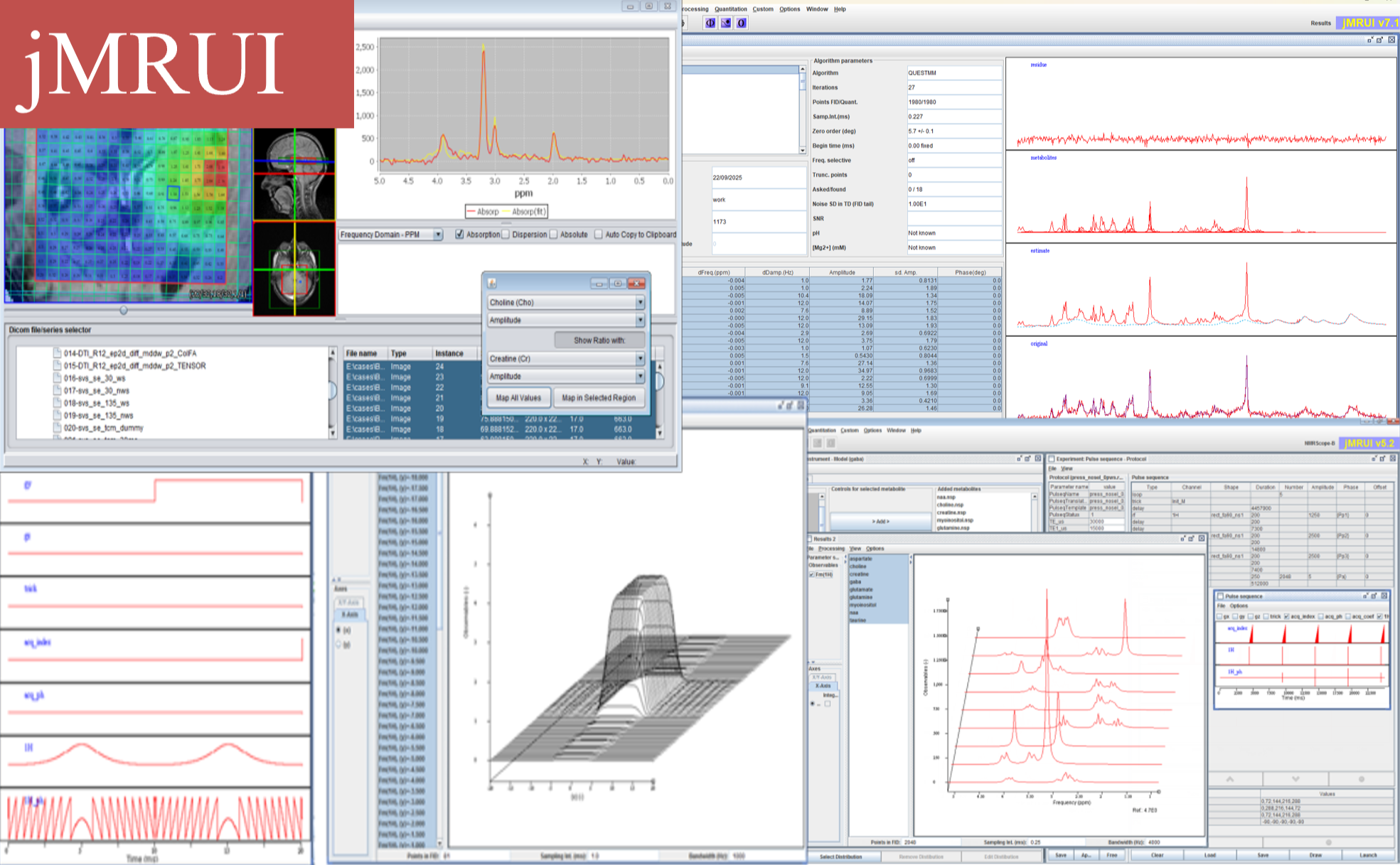 MR Spectroscopy: Development coordination and co-development of jMRUI
