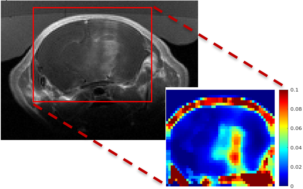 Perfusion MRI: Quantification of blood-brain-barrier permeability