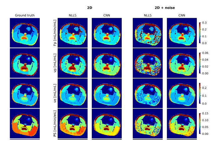 Perfusion MRI: AI methods for DCE-(DSC-)MRI