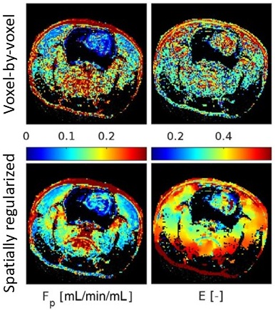 Perfusion MRI: Spatially regularized estimation of perfusion maps