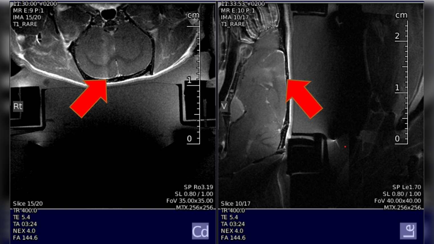 Applications of focused ultrasound (FUS)