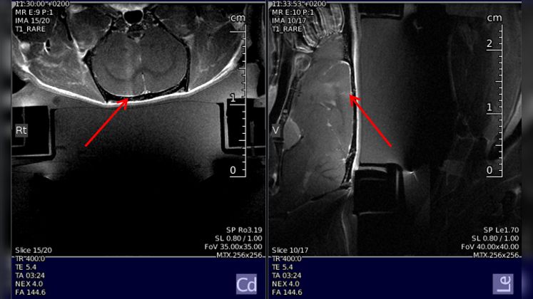 Applications of focused ultrasound (FUS)